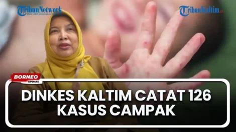 maxresdefaultDINKESKALTIMCATAT126KASUSCAMPAKA2026